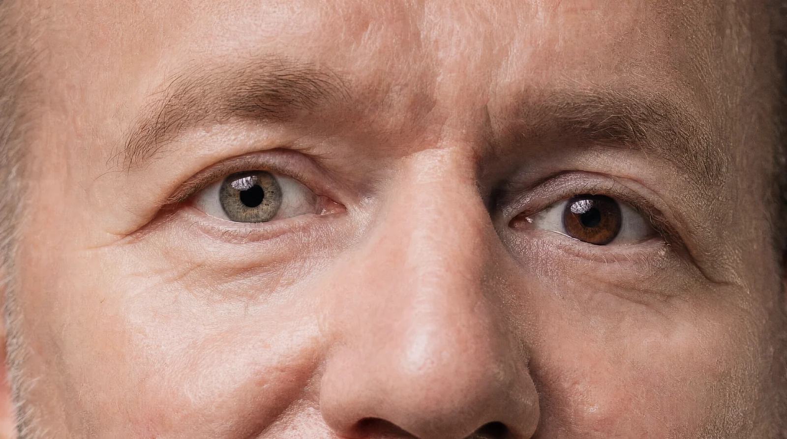Mikes Augen — links hell grau-grün, rechts dunkelbraun