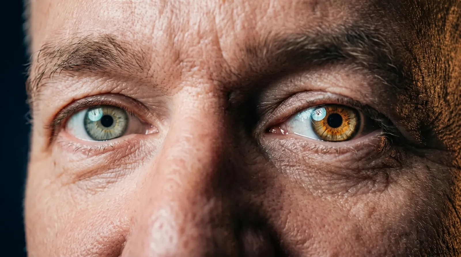 Mikes Augen — links grün-grau, rechts haselbraun