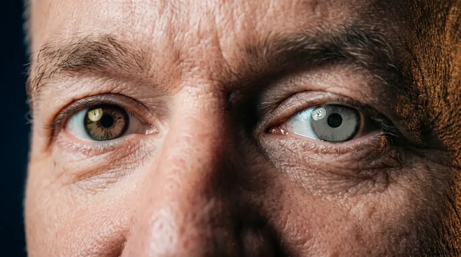Mikes Augen — links dunkelbraun, rechts grün-grau
